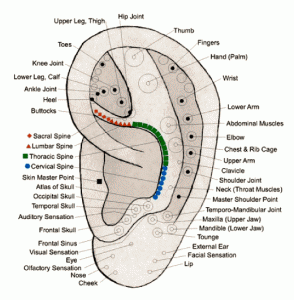 ausų akupunktūra