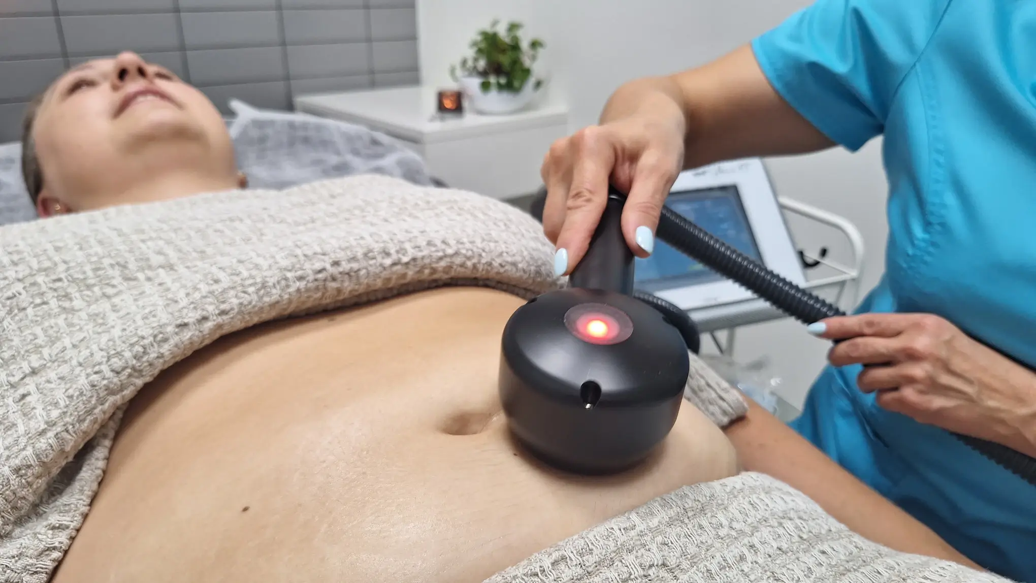 kriolipolizes terapijos privalumai