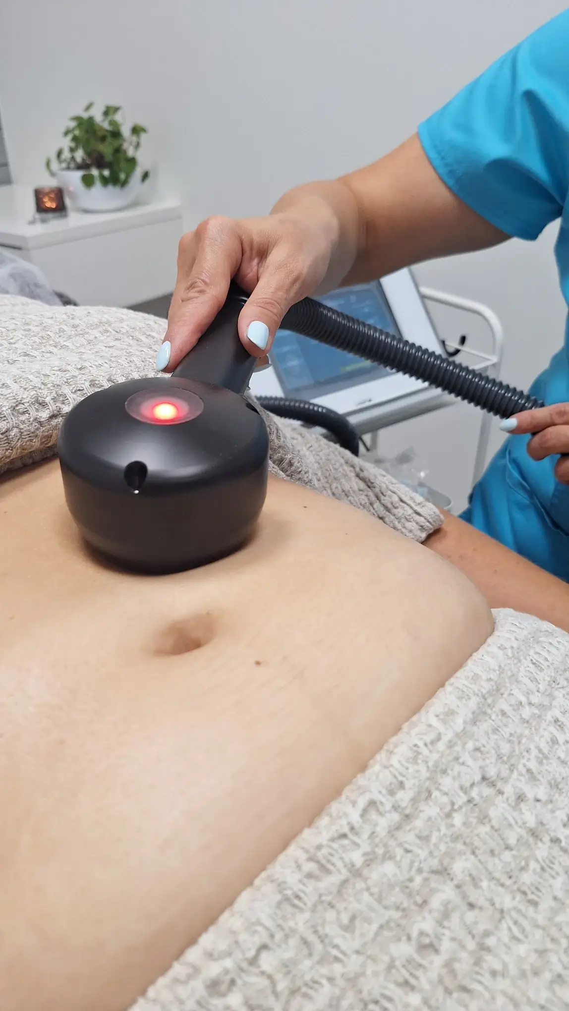 kriotermijos procedura vilniuje