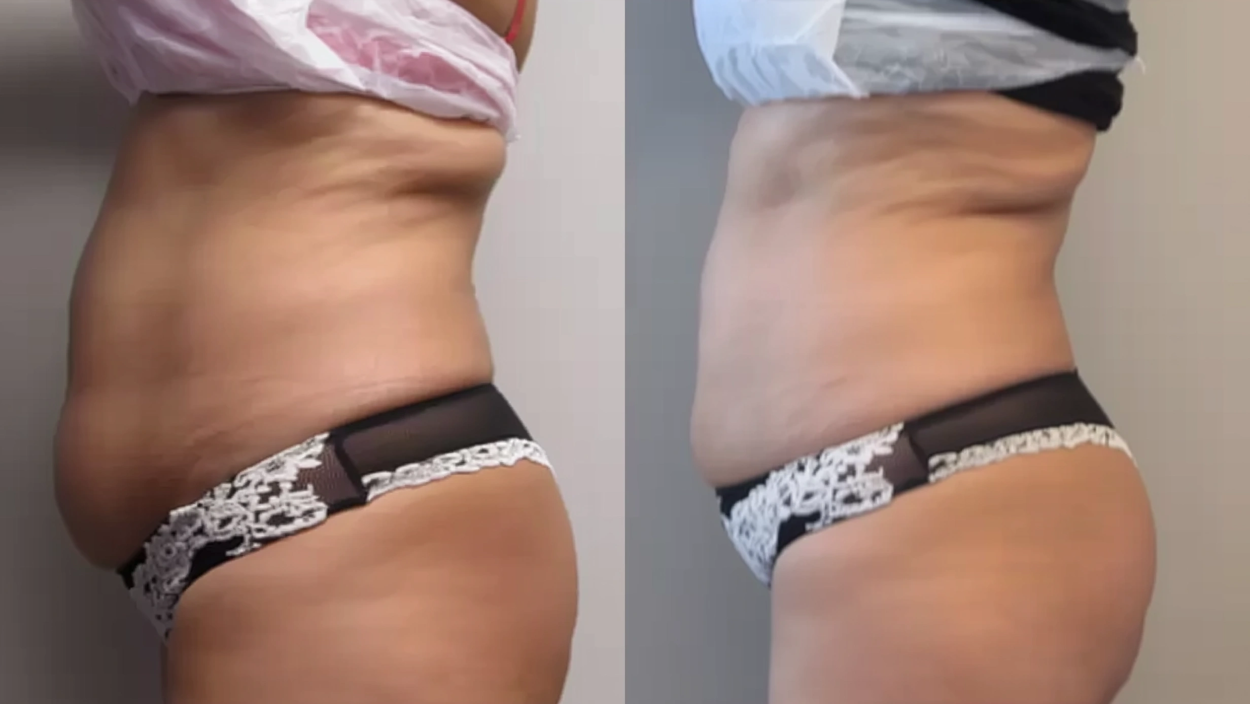 kriotermijos terapijos klinika