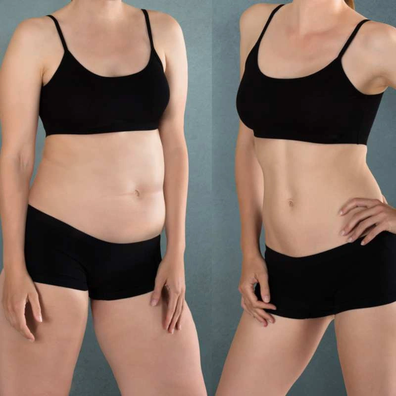 salcio terapijos privalumai