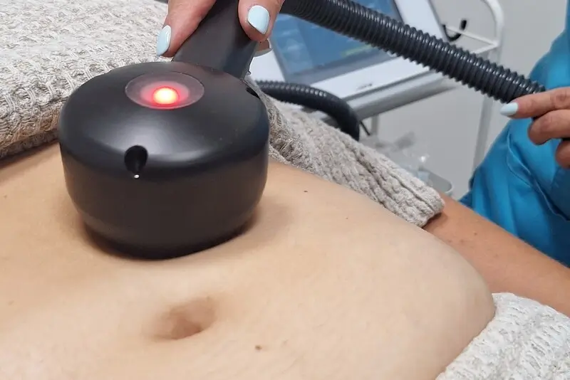 Krioterapija salcio terapija